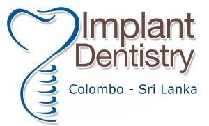 Dental Implant Surgery Colombo, Sri Lanka